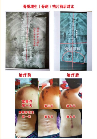 建国75周年特别报道著名中医专家、国医名师---杨宗仙