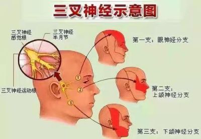 中国好医生—蒋学林 三叉神经痛就服全蝎蜈蚣多肽