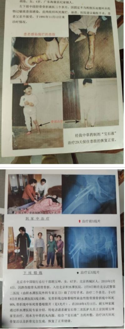 承千年文化 扬中医德馨 特别报道中国当代名医——谢宝石